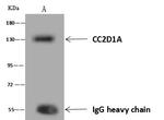 CC2D1A Antibody in Immunoprecipitation (IP)