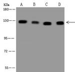 CC2D1A Antibody in Western Blot (WB)