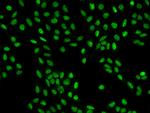 CCAR1 Antibody in Immunocytochemistry (ICC/IF)