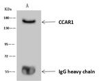 CCAR1 Antibody in Immunoprecipitation (IP)