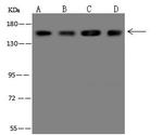 CCAR1 Antibody in Western Blot (WB)
