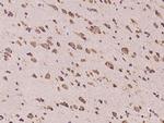 CCDC47 Antibody in Immunohistochemistry (Paraffin) (IHC (P))