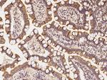 CCDC47 Antibody in Immunohistochemistry (Paraffin) (IHC (P))