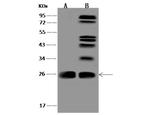 CCDC90B Polyclonal Antibody