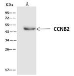 Cyclin B2 Antibody in Immunoprecipitation (IP)
