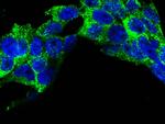 CCR3 Antibody in Immunocytochemistry (ICC/IF)