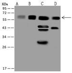 CCT3 Polyclonal Antibody