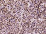 CD2AP Antibody in Immunohistochemistry (Paraffin) (IHC (P))
