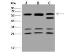 CD2BP2 Polyclonal Antibody