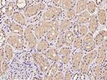 Cdc34 Polyclonal Antibody