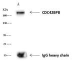 MRCK beta Antibody in Immunoprecipitation (IP)