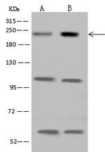 MRCK beta Antibody in Western Blot (WB)