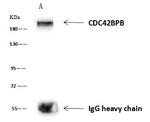 MRCK beta Antibody in Immunoprecipitation (IP)