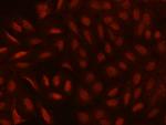CDYL Antibody in Immunocytochemistry (ICC/IF)