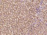 CHCHD10 Antibody in Immunohistochemistry (Paraffin) (IHC (P))