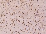 CHERP Antibody in Immunohistochemistry (Paraffin) (IHC (P))