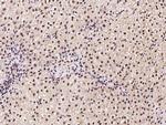 CHERP Antibody in Immunohistochemistry (Paraffin) (IHC (P))