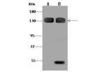 CHERP Antibody in Western Blot (WB)