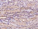 CHMP4A Antibody in Immunohistochemistry (Paraffin) (IHC (P))