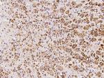 NARFL Polyclonal Antibody
