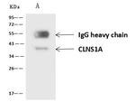 CLNS1A Antibody in Immunoprecipitation (IP)