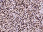 CLPP Antibody in Immunohistochemistry (Paraffin) (IHC (P))
