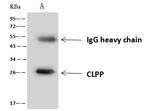 CLPP Antibody in Immunoprecipitation (IP)