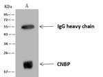 ZNF9 Antibody in Immunoprecipitation (IP)