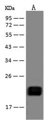 ZNF9 Polyclonal Antibody