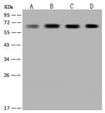 CoA Synthase Polyclonal Antibody