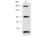 Endostatin Polyclonal Antibody