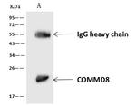COMMD8 Antibody in Immunoprecipitation (IP)
