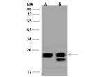 COMMD8 Antibody in Western Blot (WB)