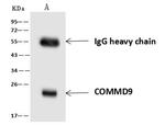COMMD9 Antibody in Immunoprecipitation (IP)