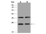 COMMD9 Polyclonal Antibody