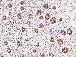 CPS1 Polyclonal Antibody