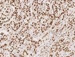 CPSF6 Antibody in Immunohistochemistry (Paraffin) (IHC (P))