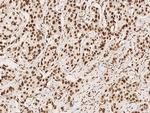 CPSF6 Antibody in Immunohistochemistry (Paraffin) (IHC (P))