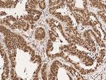 CPSF6 Antibody in Immunohistochemistry (Paraffin) (IHC (P))