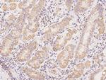 CSK Polyclonal Antibody