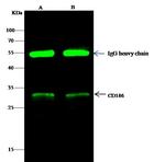 CXCR6 Antibody in Immunoprecipitation (IP)