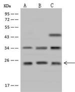 CYB561D1 Antibody in Western Blot (WB)