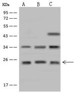 CYB561D1 Polyclonal Antibody