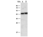 Doublecortin Polyclonal Antibody
