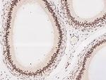 DDX17 Antibody in Immunohistochemistry (Paraffin) (IHC (P))