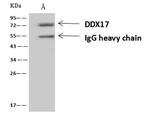 DDX17 Antibody in Immunoprecipitation (IP)