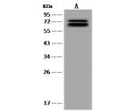 DDX17 Antibody in Western Blot (WB)