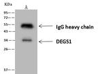 DEGS1 Antibody in Immunoprecipitation (IP)
