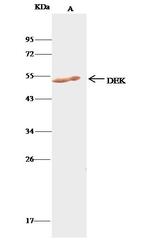DEK Antibody in Immunoprecipitation (IP)