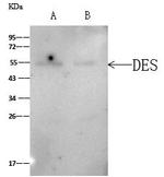Desmin Antibody in Immunoprecipitation (IP)